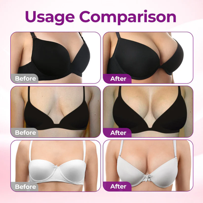 【Official Flagship Store】Targeted Breast Enhancement Advanced Nano Microneedle Patch